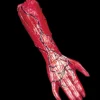Morris "Peeled Flesh - Right Arm" Human Body Part Halloween Prop