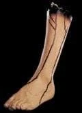 Morris "Severed Left Leg" Bloody Human Body Part Prop