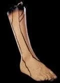 Morris Props "Severed Right Leg" Bloody Body Part Halloween Prop